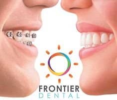 Slider image (1) Frontier Dental